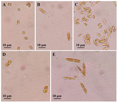Combined application of nitrogen, phosphorus, iron, and silicon improves growth and fatty acid composition in marine epiphytic diatoms